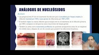 Antivirales no VIHParte 3 Análogos de nucleósidos [upl. by Olrak]