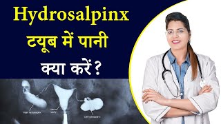 Hydrosalpinx  टयूब में पानी  Pregnancy नहीं होने का मुख्य कारण  जानिए इसका कारण और उपचार [upl. by Winebaum471]