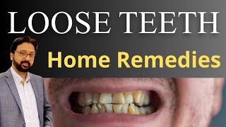 How do Dentist FIX Loose Teeth  Loose Tooth Treatment Home Remedies  Tooth Mobility [upl. by Egwin]