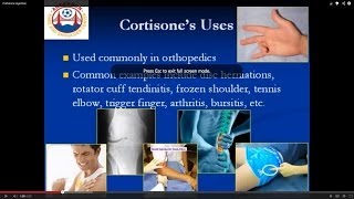 Your guide to cortisone injections [upl. by Wolk]