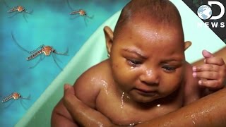 The Devastating Zika Virus Explained [upl. by Wurster]