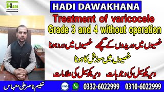 Varicocele treatment without surgery  Varicocele ka ilaj in urdu  Varicocele Causes Symptoms [upl. by Nerb]