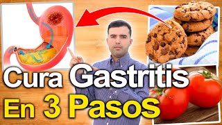 Cómo Curar La Gastritis  Cura Tu Gastritis En Una Semana  Elimina La Acidez O Reflujo Ácido [upl. by Eitsrik738]