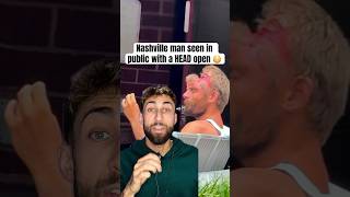 Nashville guy with an open head wound nashville man head open inpublic mystery news ratedr [upl. by Airebma176]