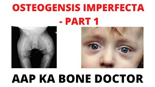 OSTEOGENESIS IMPERFECTA  PART 1  EPISODE 39 [upl. by Lela]