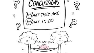 Concussion Symptoms [upl. by Lepp]