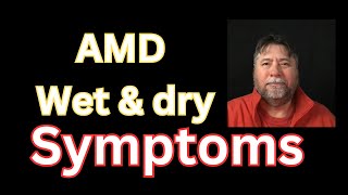 😎 Macular Degeneration Symptoms AMD Wetb amp Dry [upl. by Emersen445]