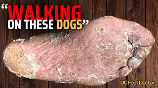 Walking On These Dogs Fungal Toenail Calluses and Peeling Skin [upl. by Cohby107]