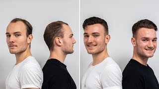 Special Transformation For Twins  Transformation with hair system  Hairsystems Heydecke [upl. by Anha]