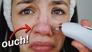 PORE  BLACKHEAD REMOVER VACUUM UP CLOSE FOOTAGE [upl. by Harahs183]