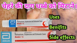 Melalite 15 Cream Benifits  Use  Side effects  Full Review in Hindi [upl. by Einahets386]