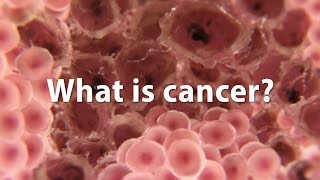 What is cancer What causes cancer and how is it treated UPDATE [upl. by Auric]