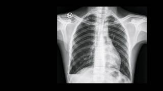 Radiology teaching points 25 Amr Saadawy [upl. by Notak]