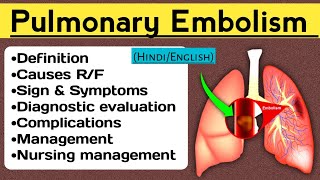 Pulmonary Embolism Lecture in hindi pulmonaryembolism nursingcriteria [upl. by Carthy500]