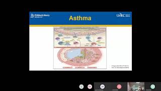 Use of Biologics in Asthma and Other Allergic Disorders Aljubran [upl. by Buote636]