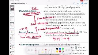 Ependymoma neurology 132  First Aid USMLE Step 1 in UrduHindi [upl. by Notserk810]