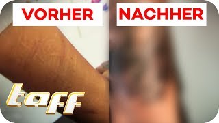 Cover Up für Narben vom Ritzen  taff  ProSieben [upl. by Shaw]