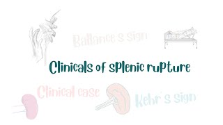 Clinicals of splenic rupture Kehr’s sign  Ballance’s sign  clinical case  DrQ [upl. by Hannan]