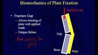 Orthopaedic Implants 1 [upl. by Curson780]