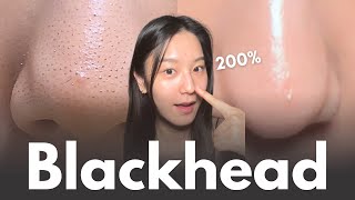 How to really remove blackheads at home in 7 days No matter your skin type [upl. by Anurb]