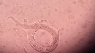 Live Strongyloides under sputum saline wet mount [upl. by Elinad]