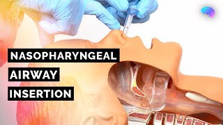 Nasopharyngeal Airway NPA Insertion  ABCDE Emergency  OSCE Guide  UKMLA  CPSA [upl. by Bound]