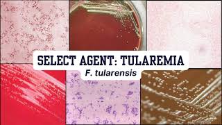 Morphology Moments  Tularemia [upl. by Gabbie]