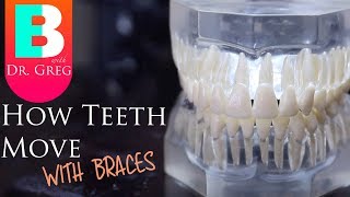 BRACES EXPLAINED How Teeth Move  Braces Work [upl. by Keisling]