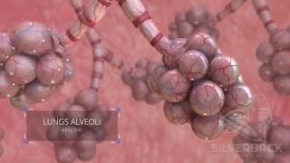 Lungs Alveoli Medical Animation [upl. by Elidad]