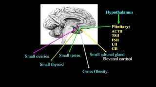 Excitotoxins Neurotoxins amp Human Neurological Disease Lecture  Dr Russell Blaylock [upl. by Gosnell]