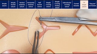 Suturing techniques [upl. by Leahcimluap746]