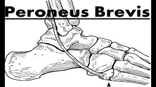 Peroneus Fibularis Brevis Tendinitis Pain Home Treatment Guide [upl. by Lipski219]