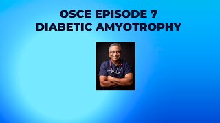 OSCE Series Episode 7  Diabetic Amyotrophy [upl. by Yessac900]