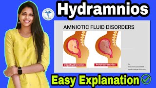 Hydramnios  Gynecology  Nursing Lecture  Easy Explanation  Nursing Association🔥 [upl. by Lubeck656]