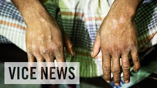 Toxic Tanneries Poisoning Workers in Bangladesh [upl. by Elleved585]