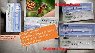 Dengue NS1 antigen positive IgM positive and IgG positive and significances in dengue fever [upl. by Nosaj]