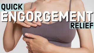 Remedies for Breast Engorgement [upl. by Uchida]