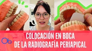 Cómo colocar las Radiografías Periapicales en boca 👄 [upl. by Eibloc]