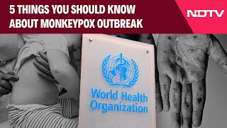 Monkeypox Virus  5 Things You Should Know About MonkeyPox Outbreak [upl. by Dorwin]