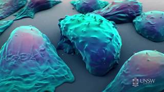 Nanoparticlebased drug delivery in the fight against cancer [upl. by Jada616]