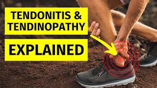 Tendinopathy amp Tendonitis Explained [upl. by Bore]