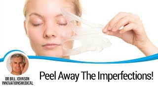 Vi Peel Featured on NBC 5  Innovations Medical Offers VI PEEL [upl. by Tarsuss]