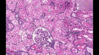 Histopathology Kidney Acute tubular necrosis [upl. by Reisch]