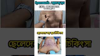 Gynecomastia treatment [upl. by Ardnac]