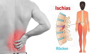 5 einfache Übung um den Ischiasnerv zu entlasten [upl. by Nauqyaj953]