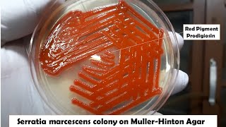 Beautiful colony of bacteria Serratia marcescens [upl. by Angrist]