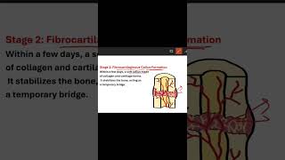 टुटी हुई हड्डी कैसे जुड़ती है stages of fracture healing bonehealing [upl. by Atnicaj499]