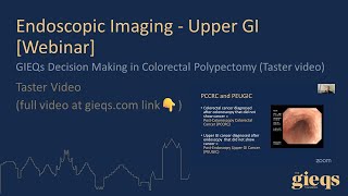 GIEQs Decision Making in Colorectal Polypectomy Taster video [upl. by Botti]