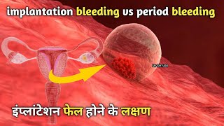 implantation symptoms  implantation bleeding vs period  implantation symptom  Ovulation [upl. by Henrieta]