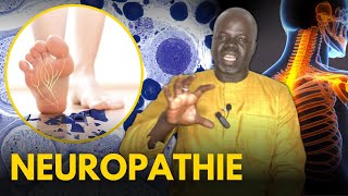 Neuropathie 1   Causes et Conséquences   Pr Ousmane Ndiaye  SAMA XALAAT TV [upl. by Amorita981]